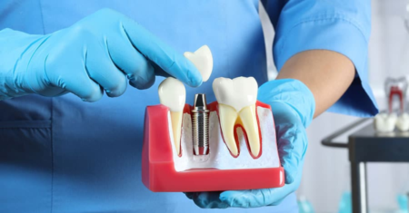 Dental Insurance